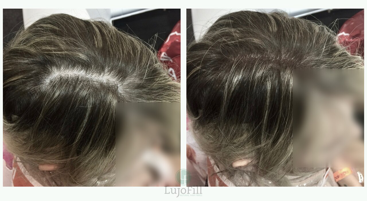 LujoFill before and after result showing fuller-looking hair at the part line