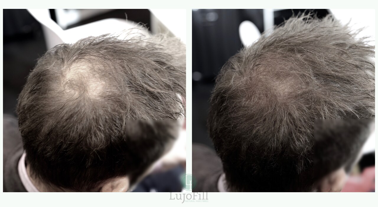 Before and after hair fibre result showing denser-looking crown coverage